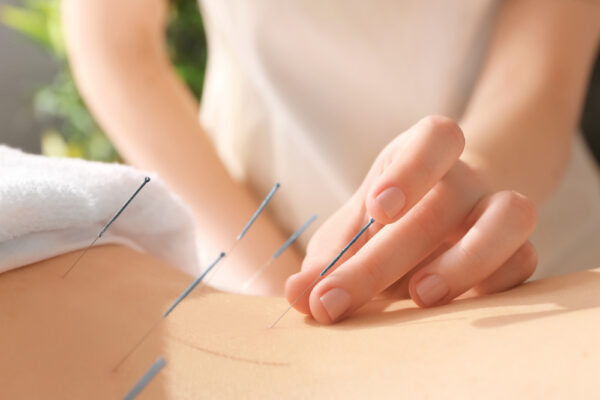 How Can Acupuncture for Addiction Aid You During Treatment?