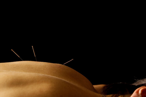 Acupuncture and Massage in Addiction Recovery